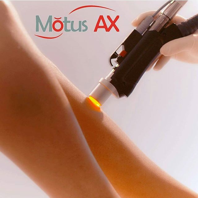 Аппара лазерной эпиляции Motus AX (Moveo)